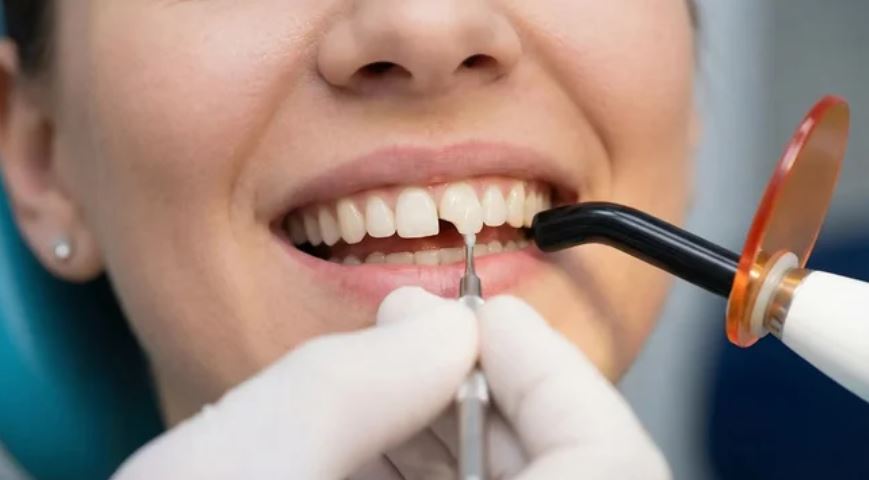Restauração e Obturação Dentária